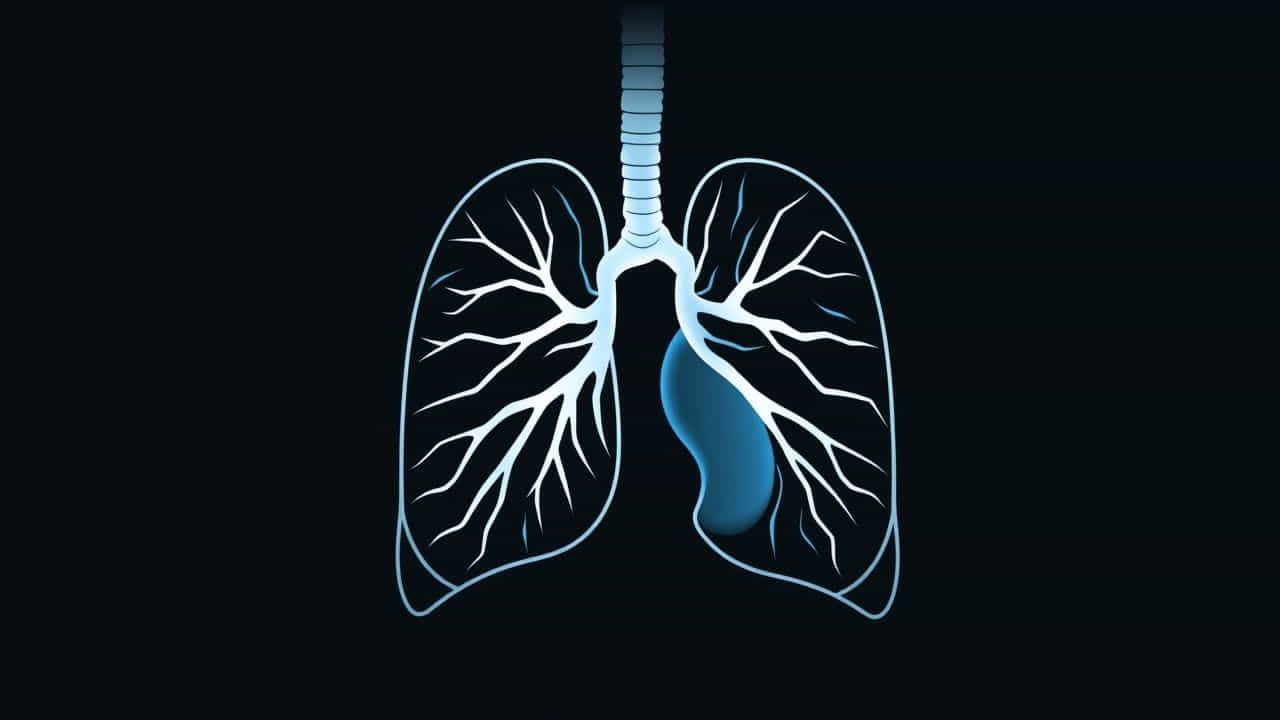 Qu'Est Ce Qu'Un Streaker